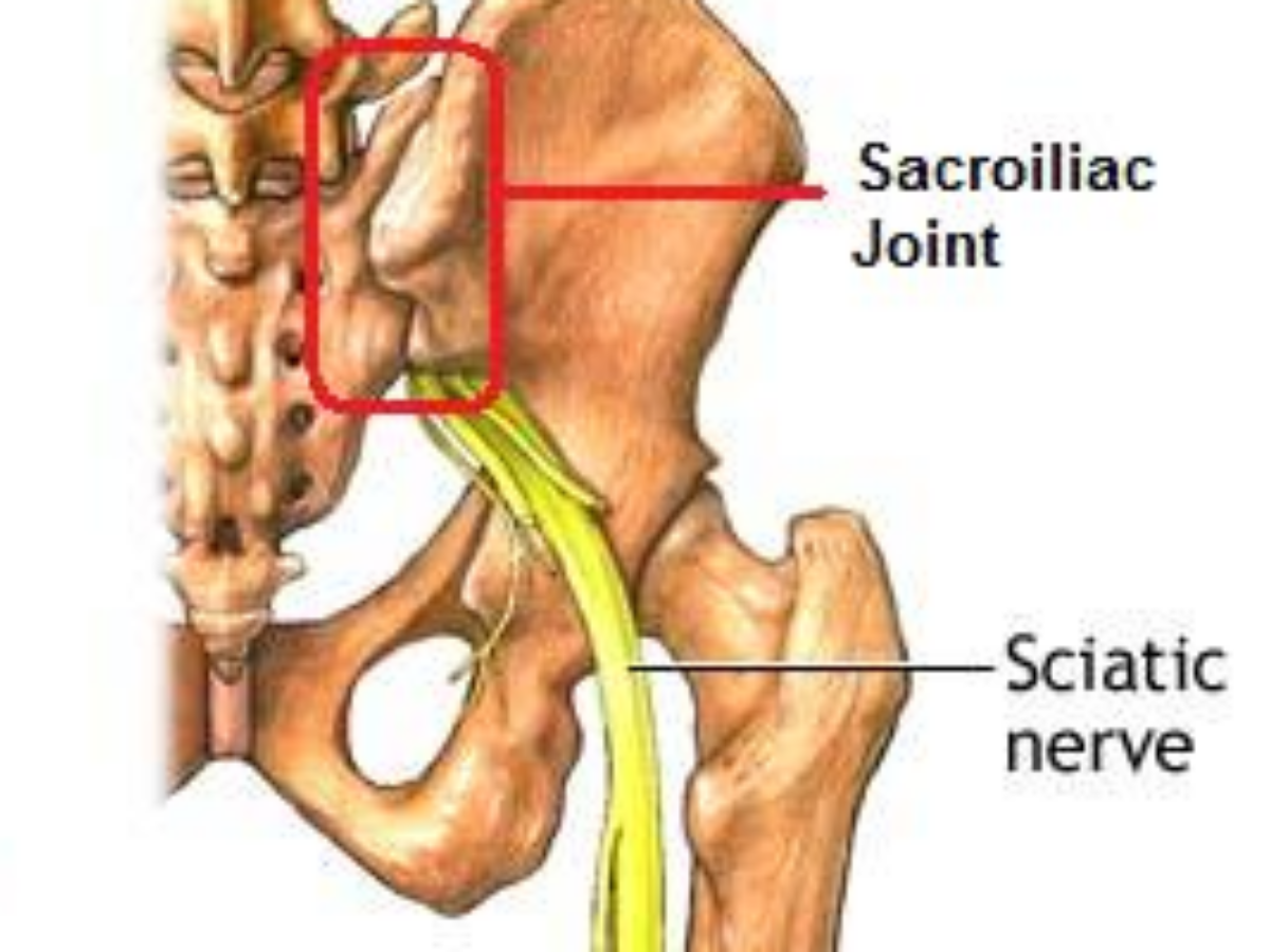 Muscles Around Sacroiliac Joint
